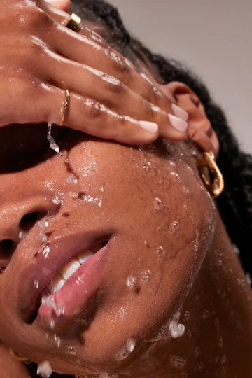Blemishes